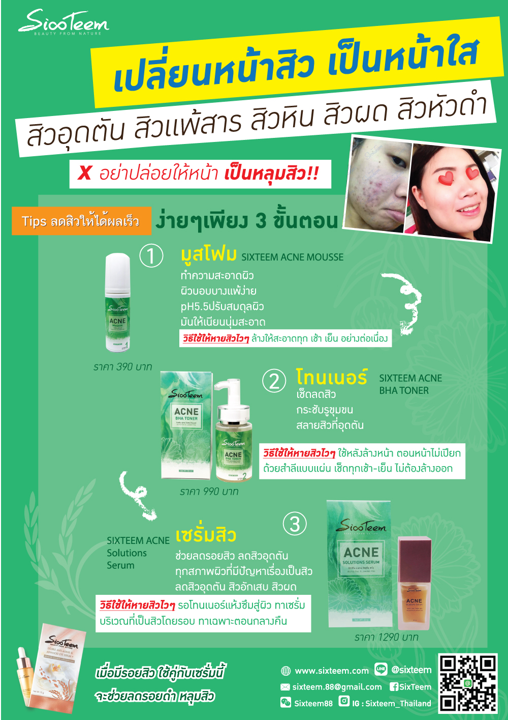 SIXTEEM ACNE BHA TONER โทนเนอร์ BHA ป้องกันสิว ลดสิวอุดตัน BHA3%