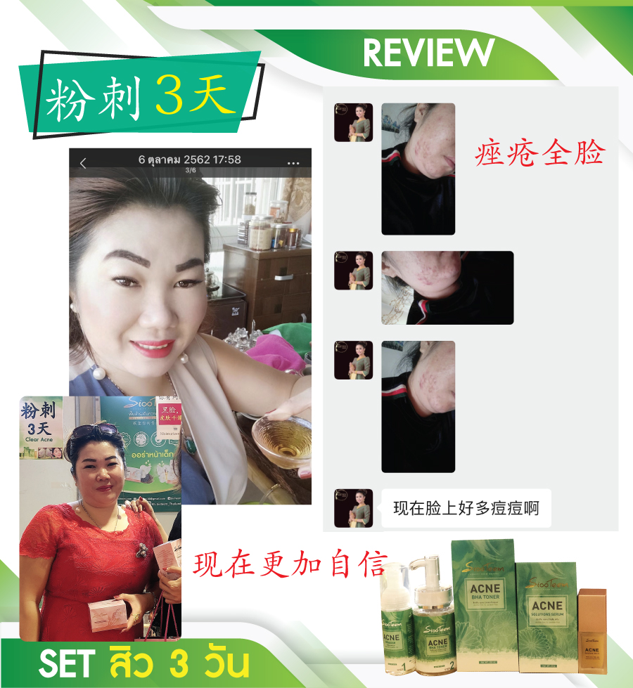 SixTeem รักษาสิว ลดสิว กระชับรูขุมขน เซ็ตรักษาสิว 3 ขั้นตอน