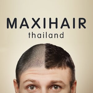 ผลิตภัณฑ์ ปกปิดหัวล้าน หัวไข่ดาว ผมร่วง ผมบาง Hair products